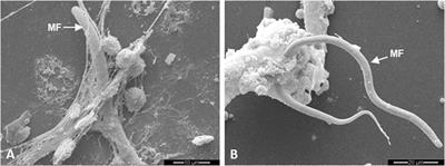 Dirofilaria immitis Microfilariae and Third-Stage Larvae Induce Canine NETosis Resulting in Different Types of Neutrophil Extracellular Traps